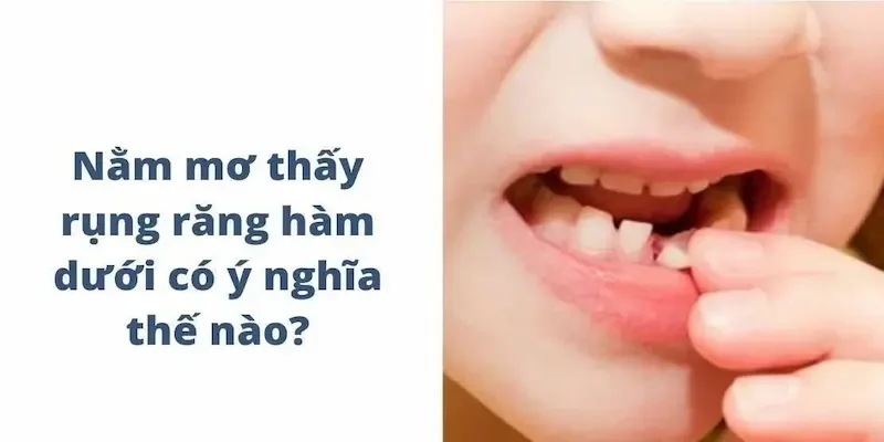 Giải mã đôi nét nằm mơ thấy rụng răng có ý nghĩa gì?